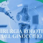 Chirurgia robotica ginocchio