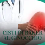 Cisti di Baker