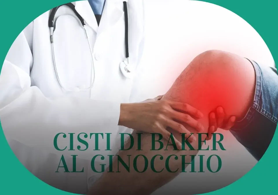 Cisti di Baker