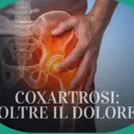 Coxartrosi