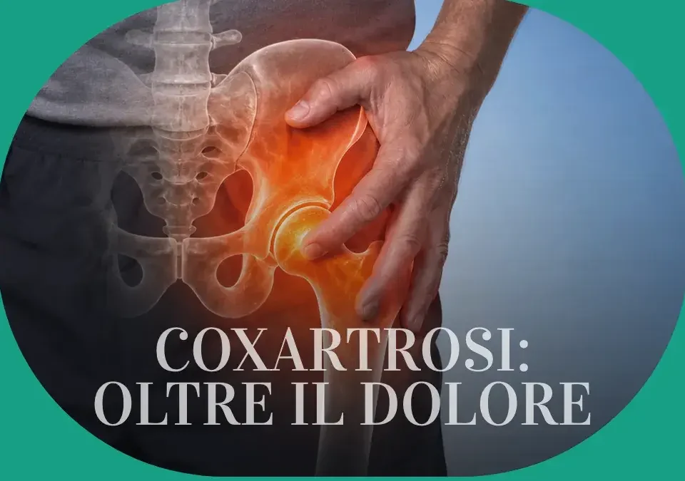 Coxartrosi